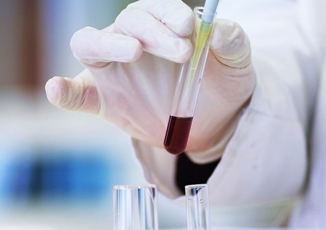 In-Home Diagnostic Services